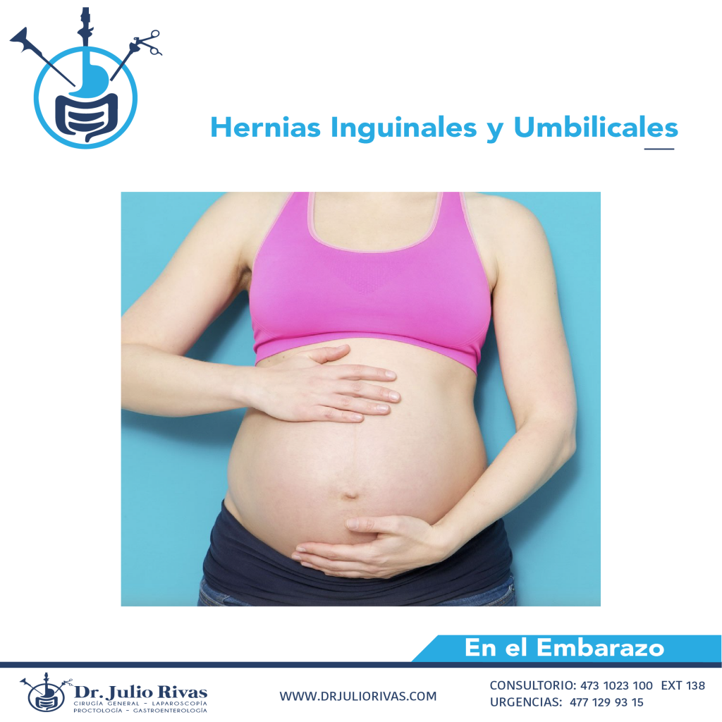 HERNIAS INGUINALES Y UMBILICALES DURANTE EL EMBARAZO